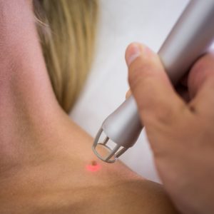 Skin Allergy Test Machine